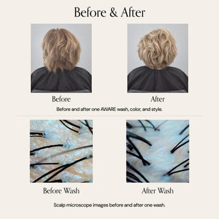 Before and after