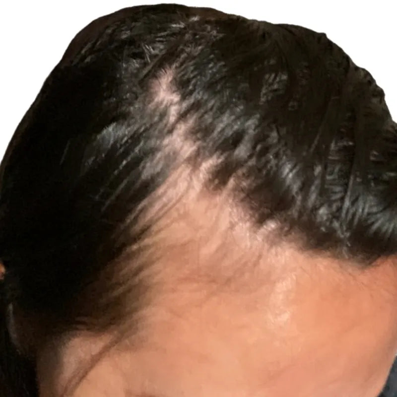 Hairline, baseline