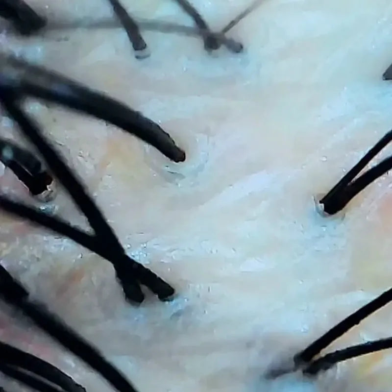 Scalp surface after cleansing
