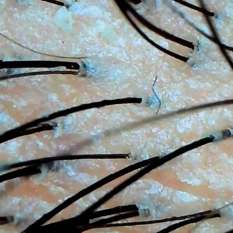Scalp surface before cleansing
