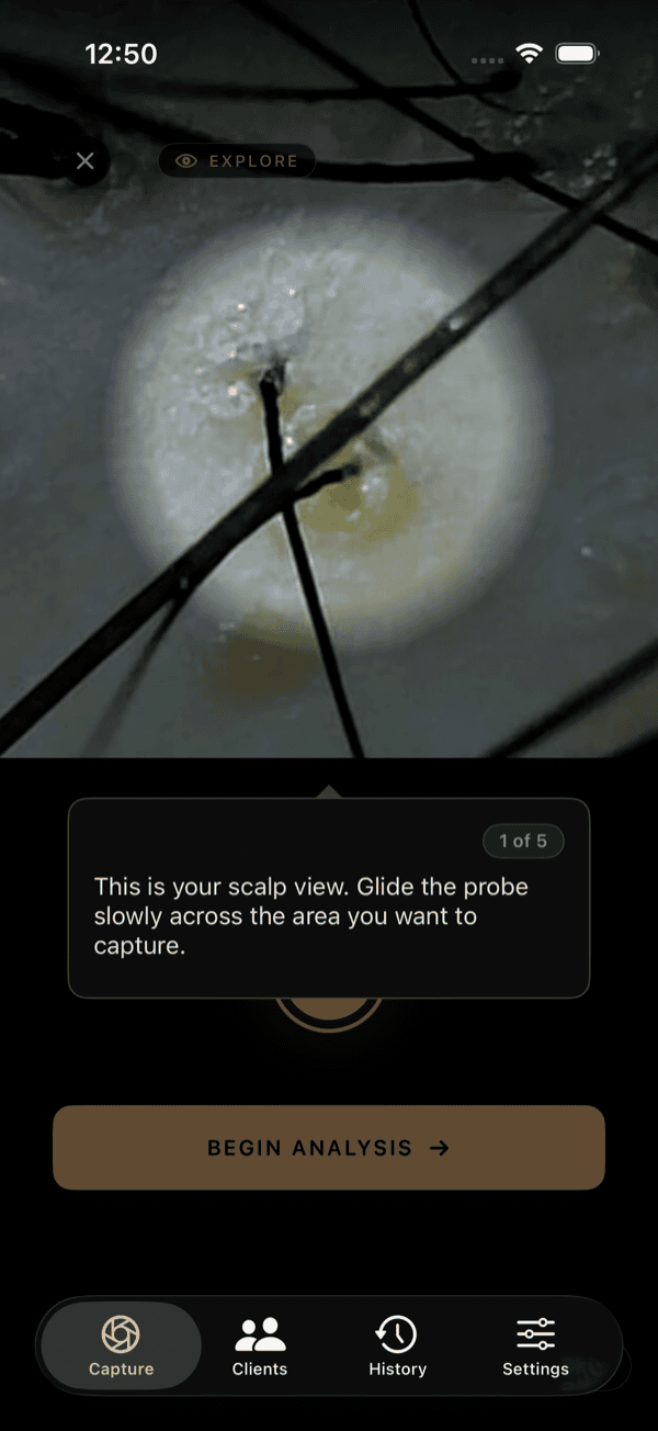 Scalp scope